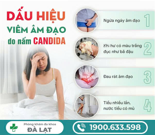 Hình ảnh minh họa